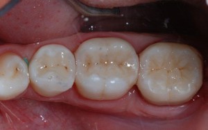 Errebi Studio Dentistico - odontoiatria conservativa